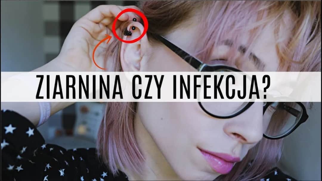 Jak skutecznie leczyć ziarninę po piercingu i uniknąć powikłań
