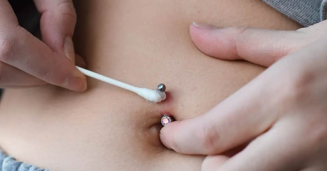 Jak skutecznie leczyć infekcję po piercingu i uniknąć powikłań