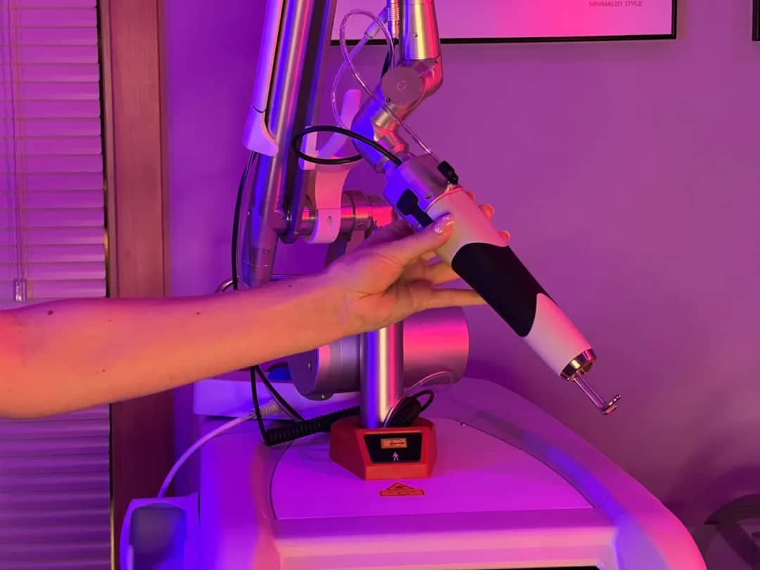 Usuwanie tatuażu w Katowicach laserem pikosekundowym. Wszystko, co warto wiedzieć!